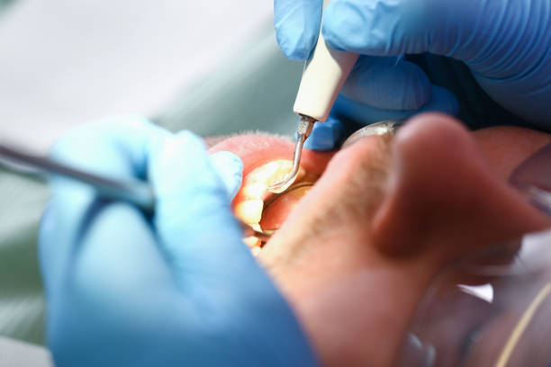Best Pediatric Emergency Dentist in Scott Af, IL