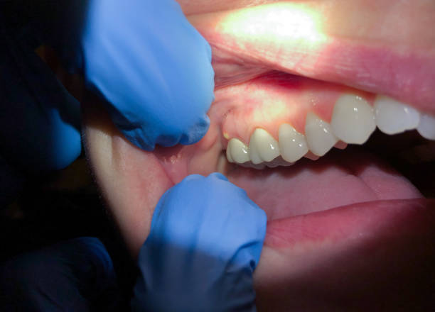 Best Emergency TMJ Treatment in Scott Af, IL
