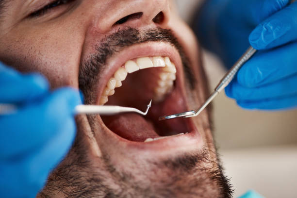 Best Emergency Tooth Extraction in Scott Af, IL